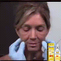 Sérum visage anti-rides instantané, anti-âge, liftant, raffermissant, estompe les ridules, améliore le teint terne, hydrate, cosmétiques coréens