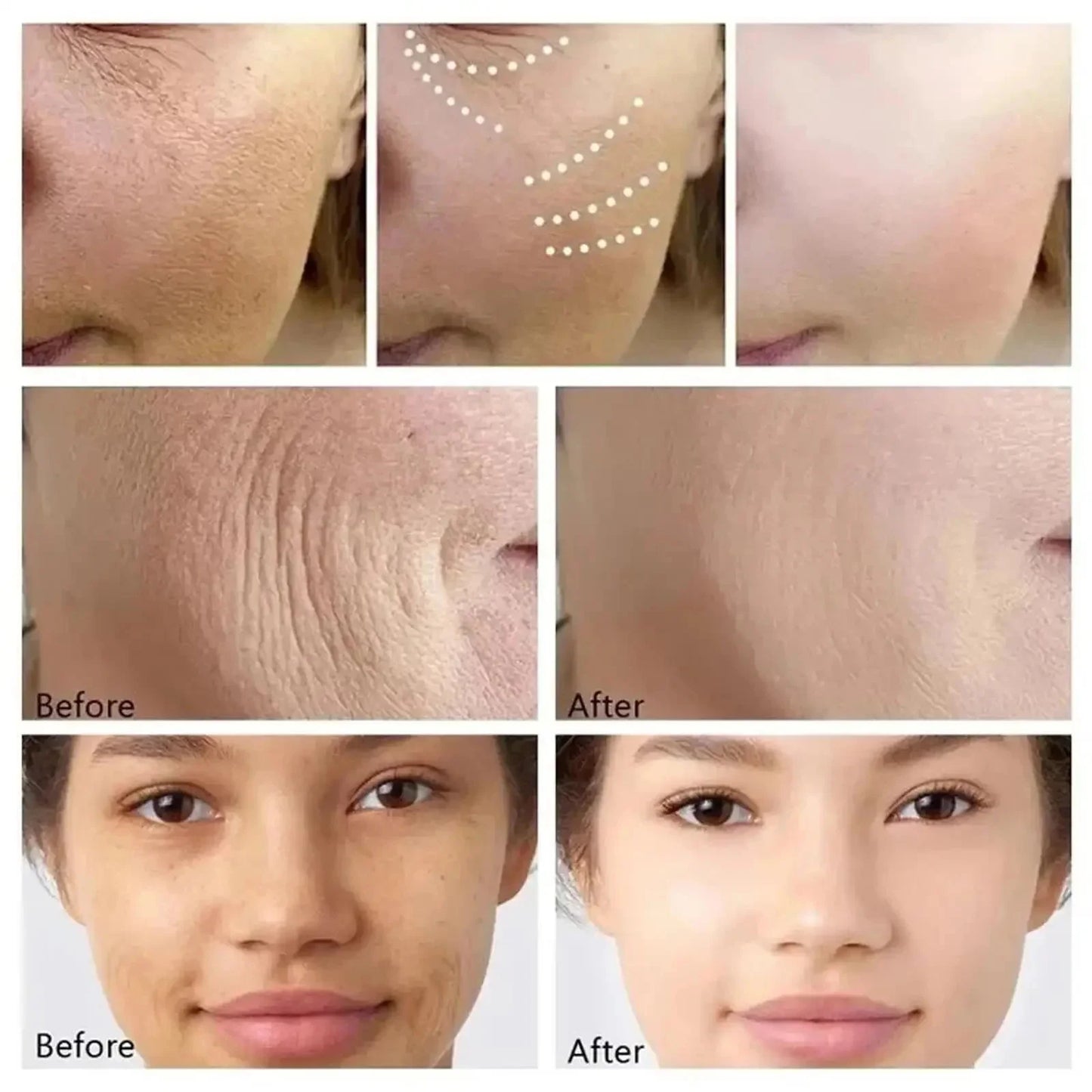 Kit anti-rides au rétinol pour le visage, raffermissement instantané, sérum anti-âge, estompe les ridules, blanchit et soigne la peau coréenne.
