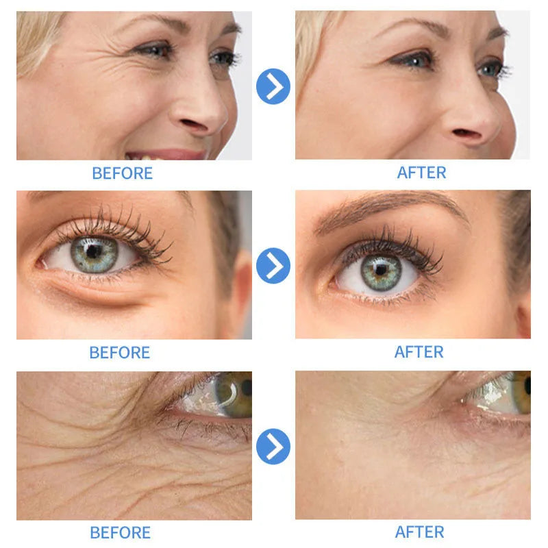 Crème visage antirides au rétinol, raffermissante, liftante, anti-âge, estompe les ridules, hydratante, blanchissante, soins de la peau, cosmétiques coréens