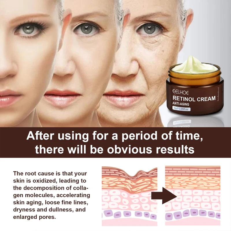 Crème visage antirides au rétinol, raffermissante, liftante, anti-âge, estompe les ridules, hydratante, blanchissante, soins de la peau, cosmétiques coréens