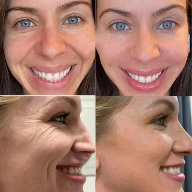 Nouvelle crème anti-rides pour le visage, effet immédiat, élimination des rides, crème anti-âge, amélioration des ridules, peau nourrissante