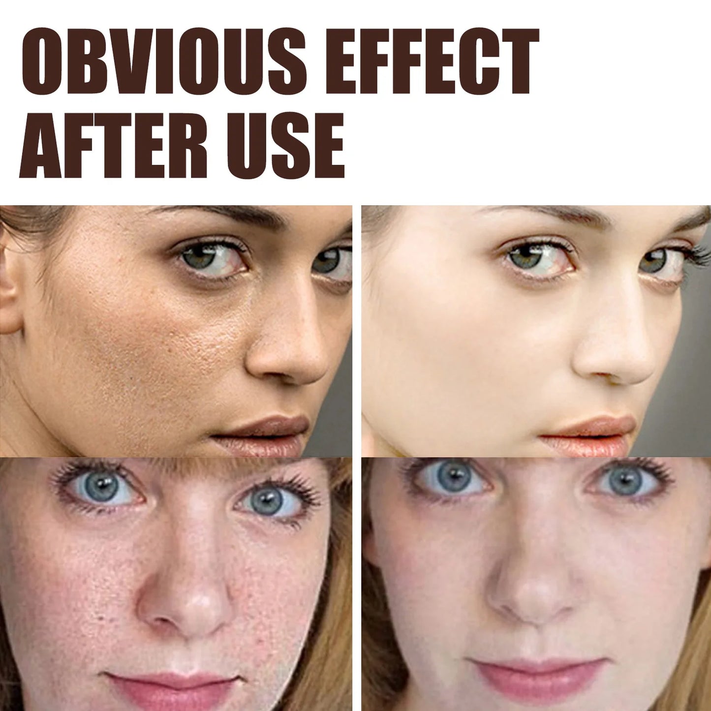 Crème visage antirides au rétinol, raffermissante, liftante, anti-âge, estompe les ridules, hydratante, blanchissante, soins de la peau, cosmétiques coréens