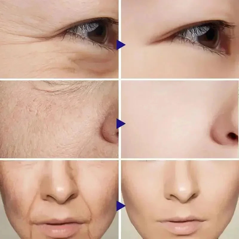 Kit anti-rides au rétinol pour le visage, raffermissement instantané, sérum anti-âge, estompe les ridules, blanchit et soigne la peau coréenne.