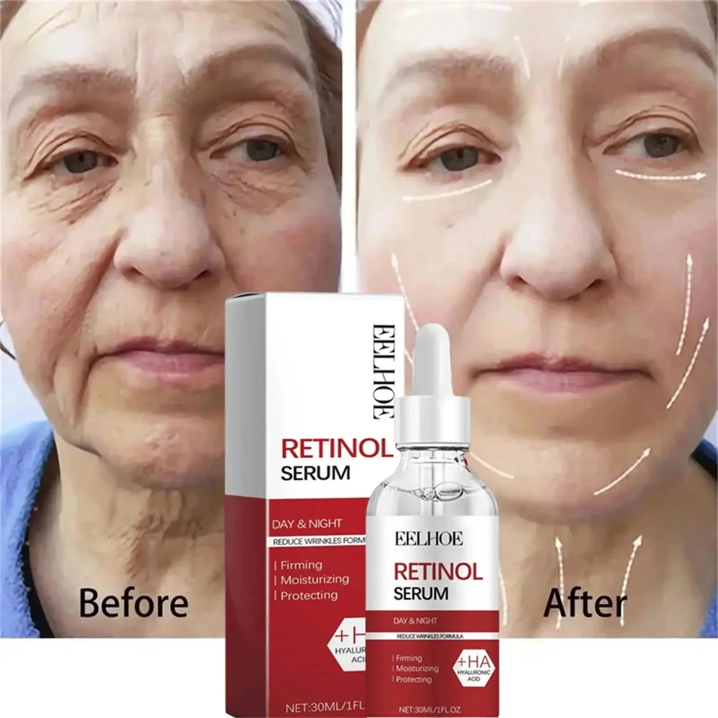 Kit anti-rides au rétinol pour le visage, raffermissement instantané, sérum anti-âge, estompe les ridules, blanchit et soigne la peau coréenne.