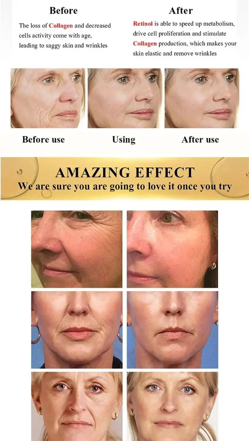 Nouvelle crème anti-rides pour le visage, effet immédiat, élimination des rides, crème anti-âge, amélioration des ridules, peau nourrissante