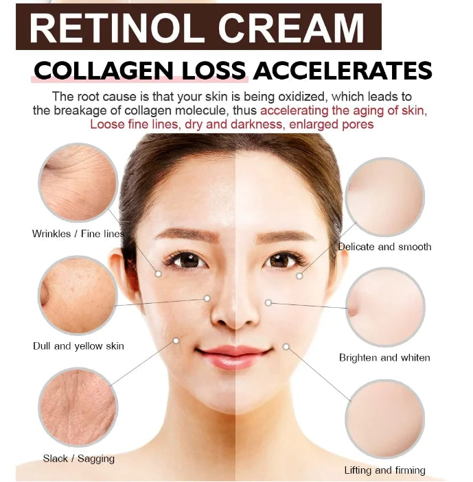 Crème visage antirides au rétinol, raffermissante, liftante, anti-âge, estompe les ridules, hydratante, blanchissante, soins de la peau, cosmétiques coréens