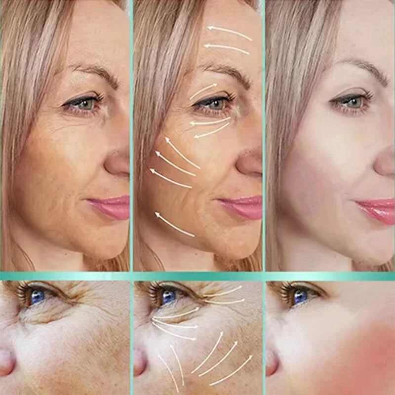 Nouvelle crème anti-rides pour le visage, effet immédiat, élimination des rides, crème anti-âge, amélioration des ridules, peau nourrissante