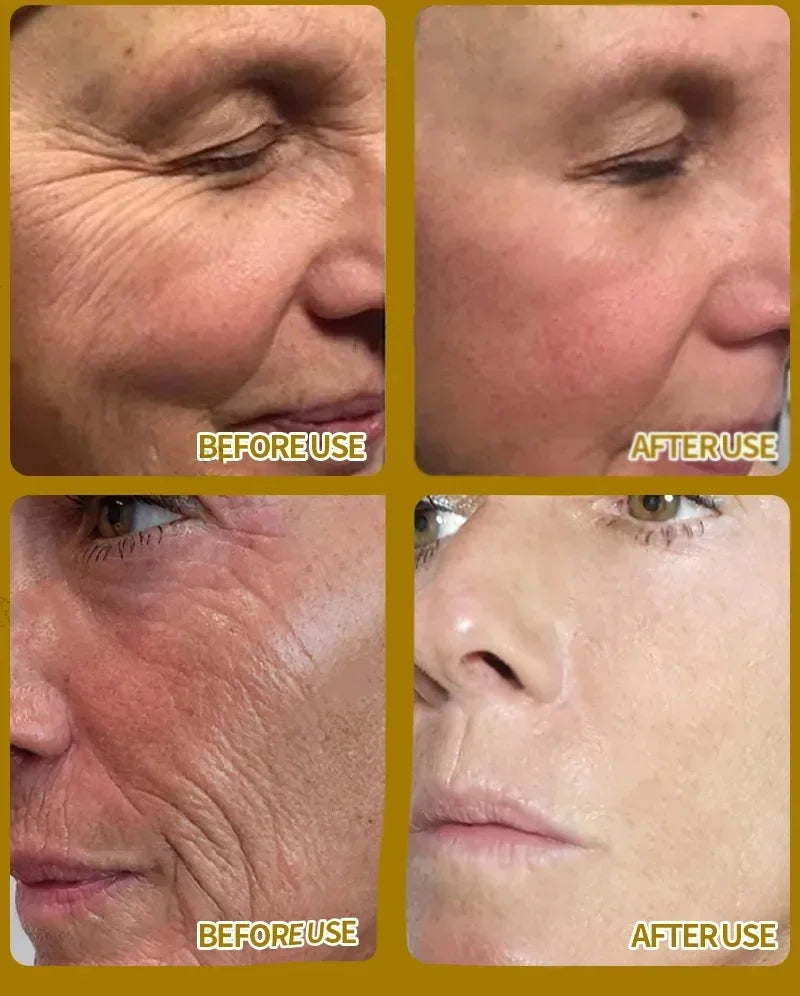 Sérum visage anti-rides instantané, anti-âge, liftant, raffermissant, estompe les ridules, améliore le teint terne, hydrate, cosmétiques coréens