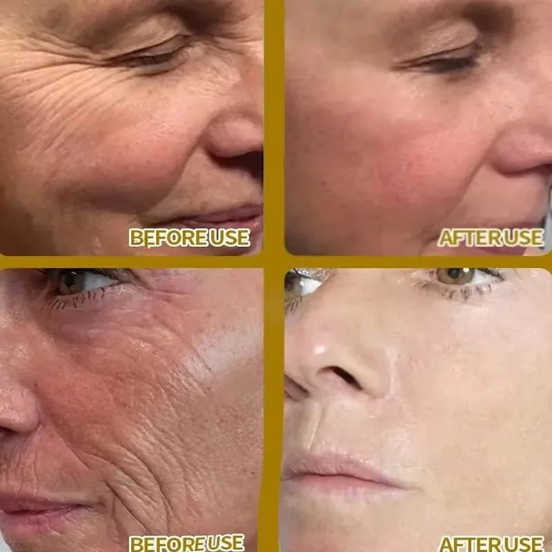 Sérum visage anti-rides instantané, anti-âge, liftant, raffermissant, estompe les ridules, améliore le teint terne, hydrate, cosmétiques coréens
