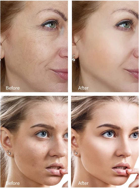 Crème visage antirides au rétinol, raffermissante, liftante, anti-âge, estompe les ridules, hydratante, blanchissante, soins de la peau, cosmétiques coréens