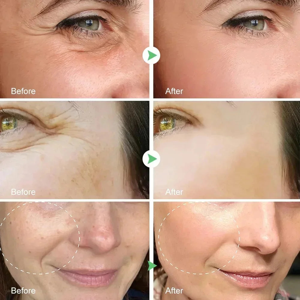 Nouvelle crème anti-rides pour le visage, effet immédiat, élimination des rides, crème anti-âge, amélioration des ridules, peau nourrissante
