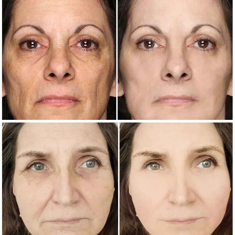 Crème visage antirides au rétinol, raffermissante, liftante, anti-âge, estompe les ridules, hydratante, blanchissante, soins de la peau, cosmétiques coréens
