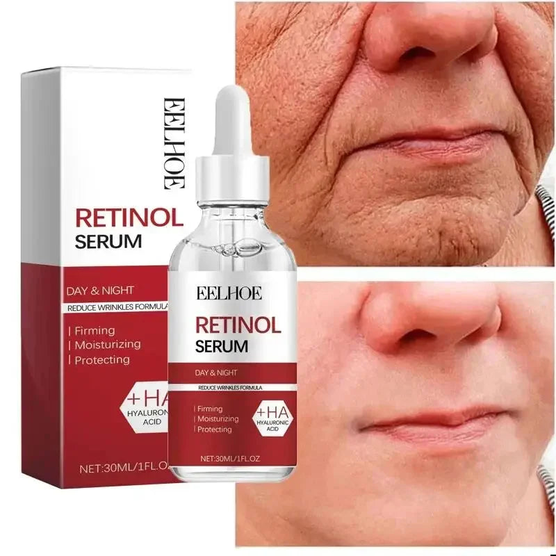 Kit anti-rides au rétinol pour le visage, raffermissement instantané, sérum anti-âge, estompe les ridules, blanchit et soigne la peau coréenne.