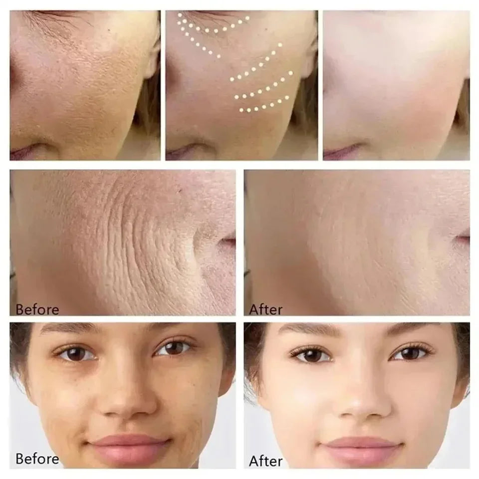 Kit anti-rides au rétinol pour le visage, raffermissement instantané, sérum anti-âge, estompe les ridules, blanchit et soigne la peau coréenne.