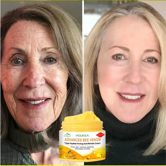 Nouvelle crème anti-rides pour le visage, effet immédiat, élimination des rides, crème anti-âge, amélioration des ridules, peau nourrissante