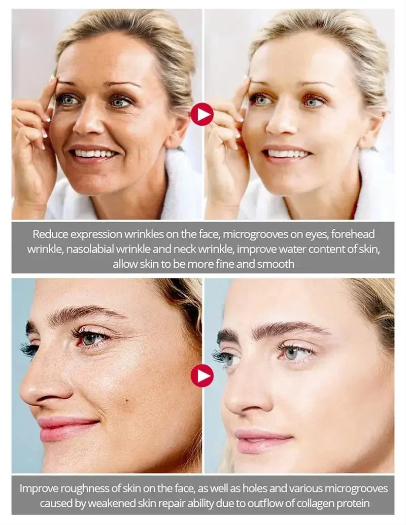 Nouvelle crème anti-rides pour le visage, effet immédiat, élimination des rides, crème anti-âge, amélioration des ridules, peau nourrissante