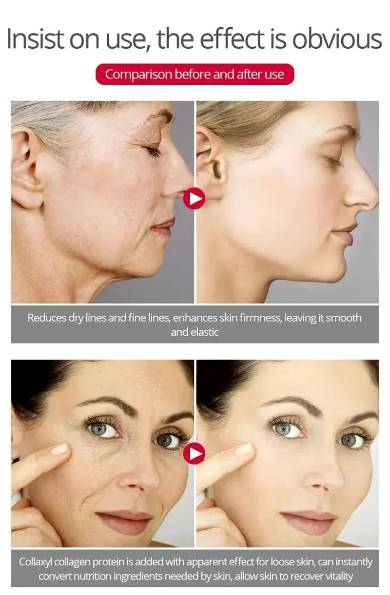 Nouvelle crème anti-rides pour le visage, effet immédiat, élimination des rides, crème anti-âge, amélioration des ridules, peau nourrissante